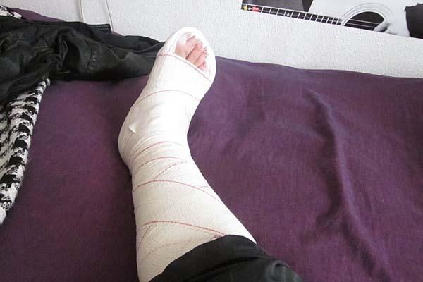 iquestEl fin del yeso para inmovilizar extremidades