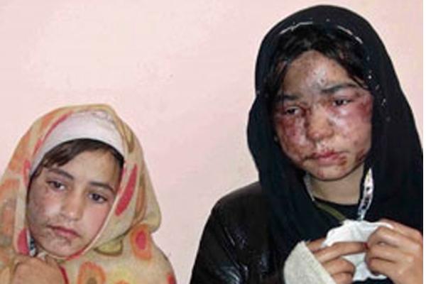 Afganistaacuten- queman con aacutecido a una mujer porque no se quiso casar