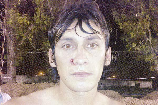 MARCA Así quedó el rostro de Brand�n luego de sufrir el impacto EL LIBERALlorena aranda