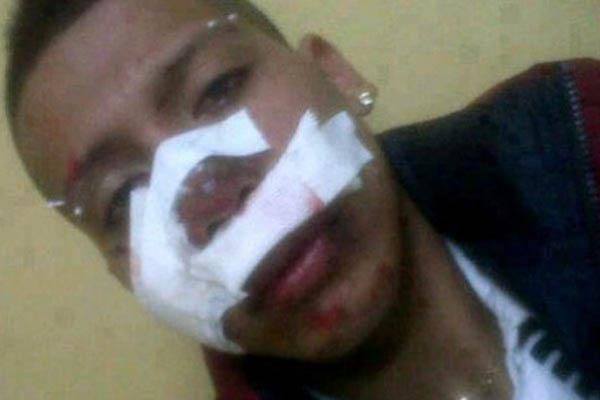 Un Wachiturro casi se mata al chocar supuestamente en su moto contra un camioacuten 