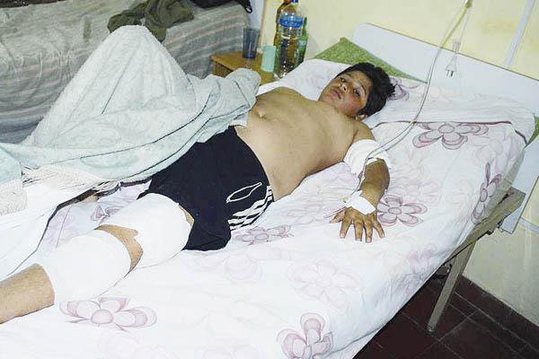 HERIDAS Las heridas sufridas por Gonzalo Snchez requirieron 36 puntos de sutura
