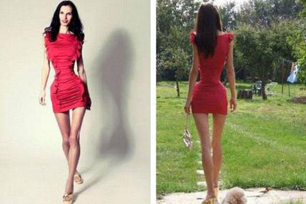 La mujer maacutes flaca del mundo  entre la belleza y la enfermedad