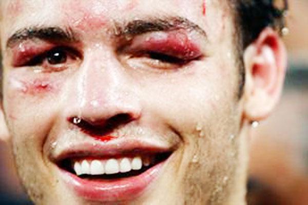 Por el doping- Sancioacuten de 10000 doacutelares para Chaacutevez Jr