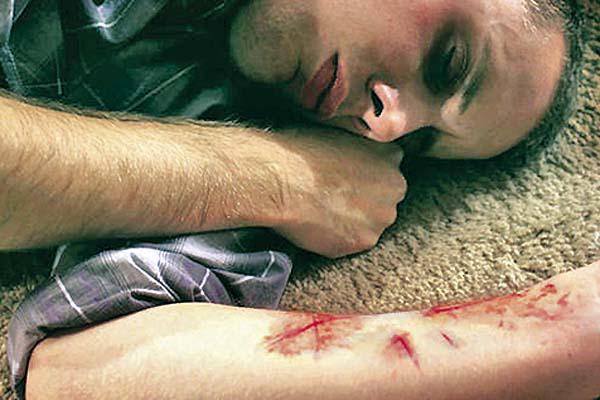 Autoagresioacuten adolescente- crece la alarma por videos subidos a la web