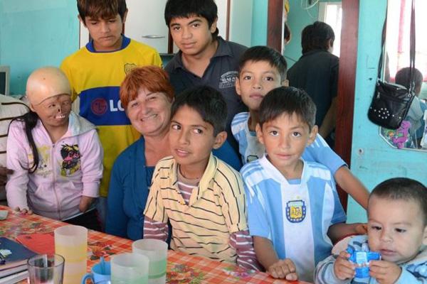 La nintildea que perdioacute el rostro pero no las ganas de vivir