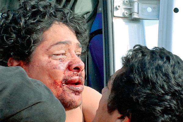 DESESPERADO Tras la paliza Coronel sufrió un profundo ataque de nervios Entre 7 personas lograron socorrerlo y ascenderlo a la ambulancia