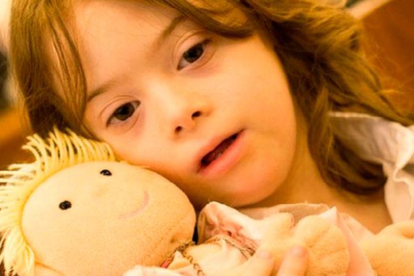 Importantes avances cientiacuteficos sobre el siacutendrome de Down