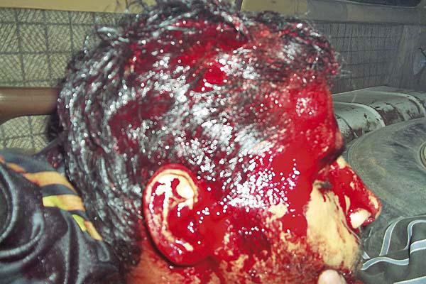 Una mujer se defendioacute y le abrioacute la cabeza a su marido con un cuchillo