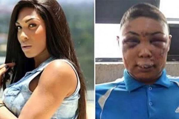 Transexual fue detenida y desfigurada por la policiacutea brasilentildea