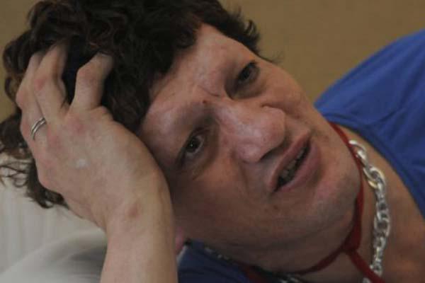 Asiacute estaacute hoy Pity aacutelvarez- rostro destrozado y sin cejas