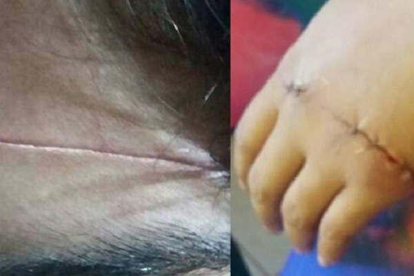 Una alumna de 12 antildeos fue atacada con una trincheta por una compantildeera