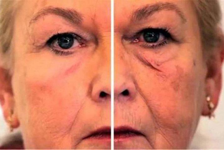 Crean una piel que simula rejuvenecer