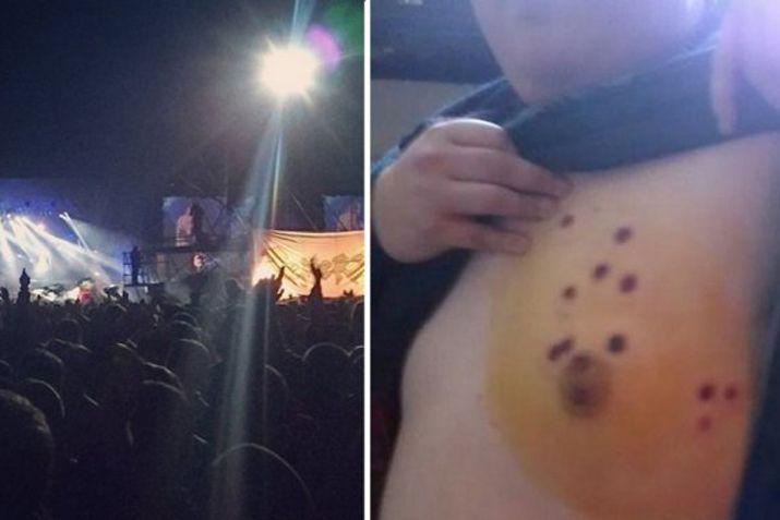 Sufrió heridas en todo el cuerpo