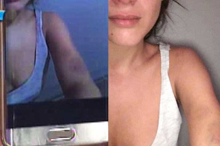 La foto de los moretones de Barbie Veacutelez