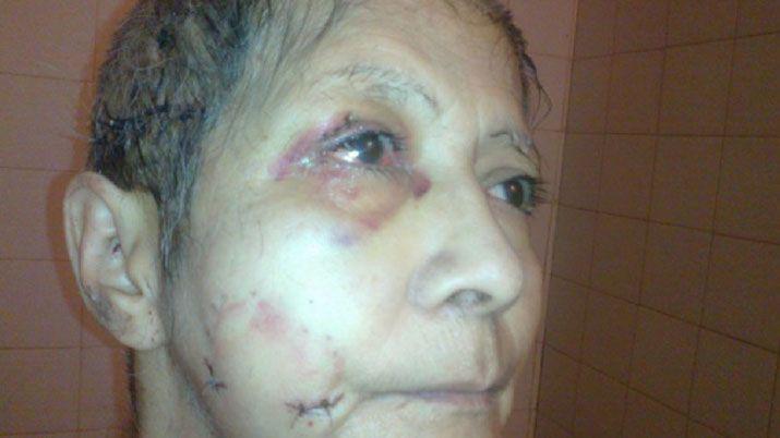 La víctima sufrió graves heridas