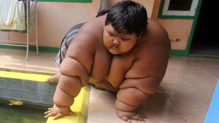 Alarmante- La historia del nene de diez antildeos que pesa 193 kilos