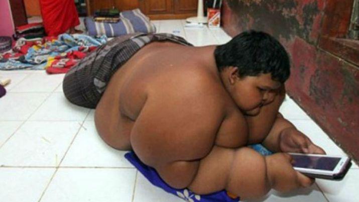 Alarmante- La historia del nene de diez antildeos que pesa 193 kilos