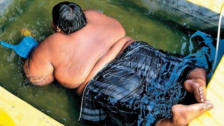 Alarmante- La historia del nene de diez antildeos que pesa 193 kilos