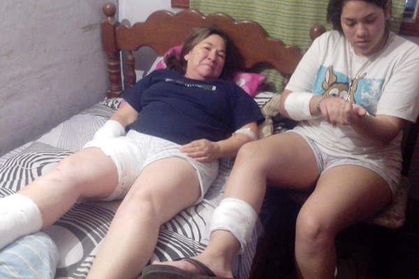 Madre e hija con graviacutesimas heridas al ser atacadas por su propio perro Pitbull