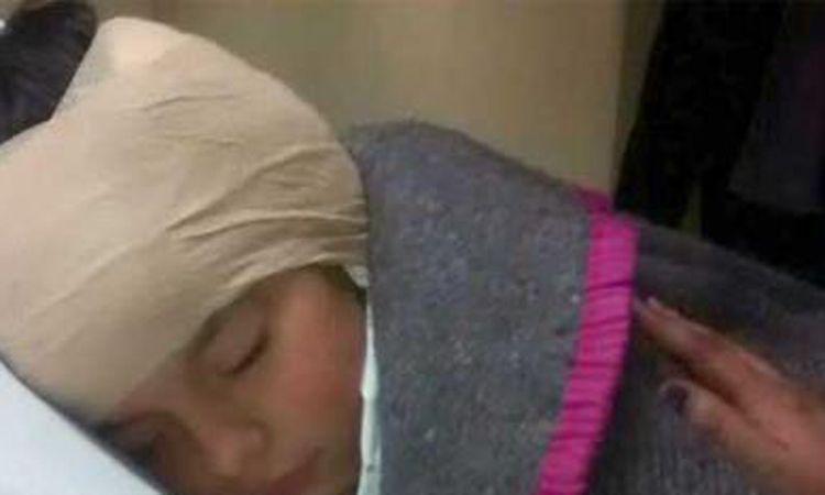 Una nena podraacute escuchar gracias a un implante coclear