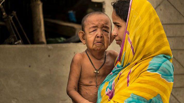 El verdadero Benjamin Button- tiene 4 antildeos y parece de 80