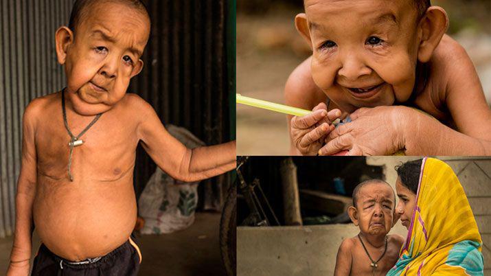 El verdadero Benjamin Button- tiene 4 antildeos y parece de 80