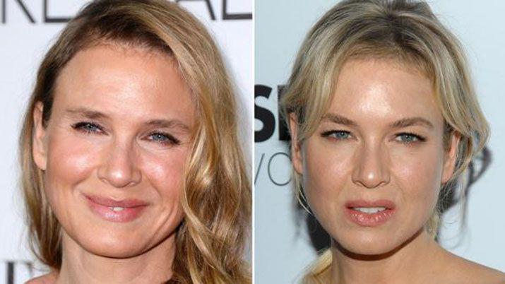 La fuerte descarga de Renee Zellweger por las criacuteticas a sus cirugiacuteas