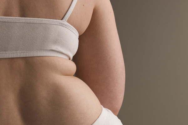 Haber superado la obesidad con la cirugiacutea me hizo sentir viva