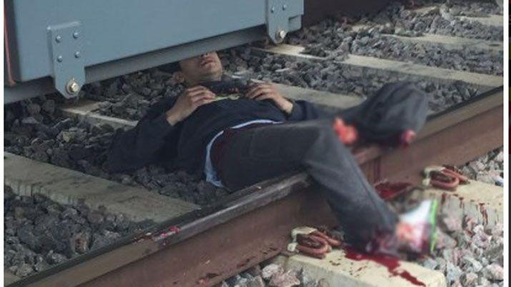 Perdió sus dos piernas