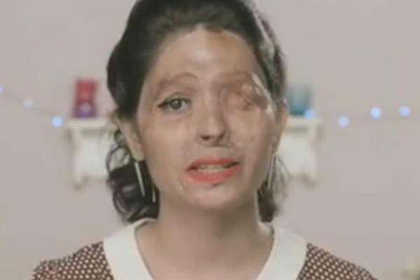 La quemaron con aacutecido pero sobrevivioacute y desfilaraacute en la escalinata del Fashion Week de Nueva York