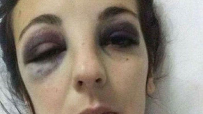 Futbolista cordobeacutes quedoacute detenido por desfigurar a su exnovia