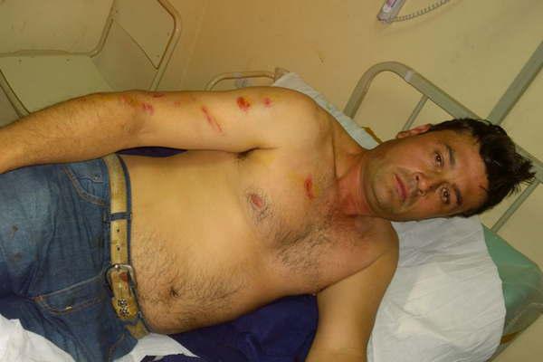 Marido celoso (y cuntildeado aliado) mandan al hospital al camionero acusado de conquistar a su mujer