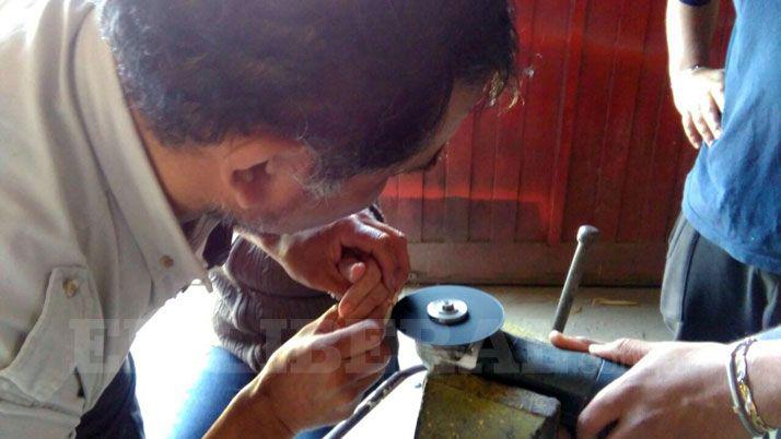 Sufrioacute un golpe en su dedo y tuvieron que cortarle el anillo con una amoladora