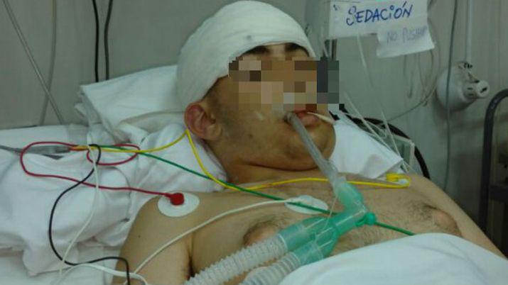 Quedó en terapia intensiva
