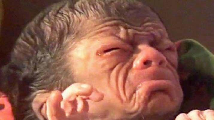 Increiacuteble- nacioacute un bebeacute repleto de pelo y arrugas