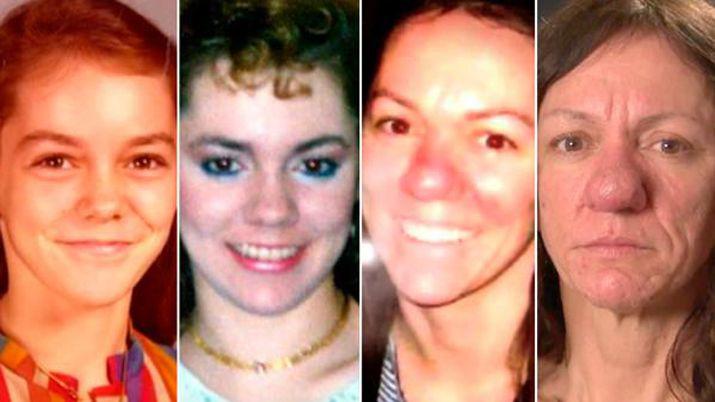 El drama de una mujer cuya nariz no para de crecer