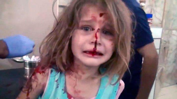 El dramaacutetico video de Aya otra nena viacutectima de la guerra en Siria