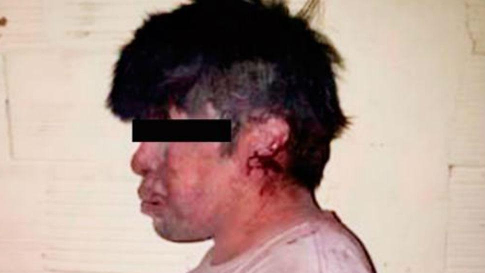 Miraacute como quedoacute sospechoso de haber violado a una nena de cinco antildeos