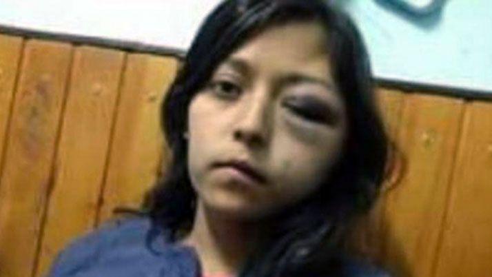 Otro caso de violencia en Mendoza- desfiguroacute a su ex