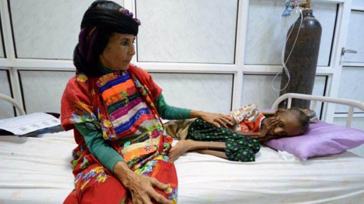 Impactante- las fotos de la adolescente de Yemen que sufre la guerra y el hambre