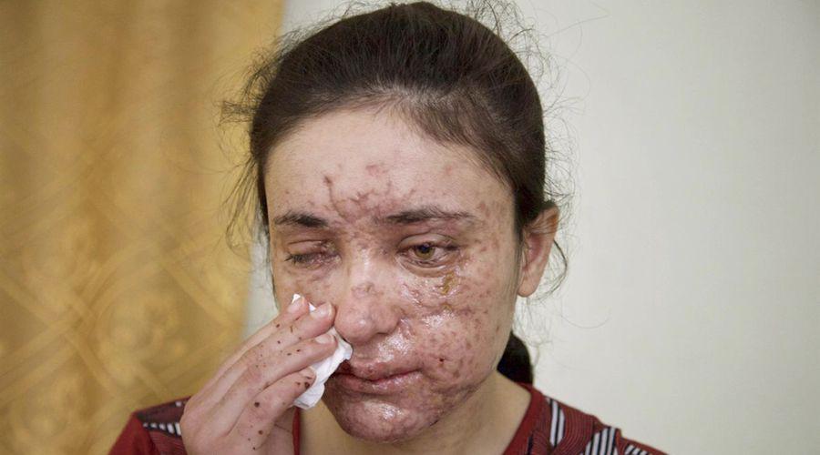 Premio Saacutejarov para dos ex esclavas sexuales de ISIS