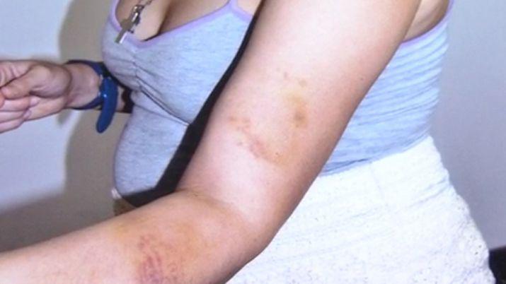 Psicoacuteloga contoacute el calvario que vivioacute durante tres antildeos con su ex