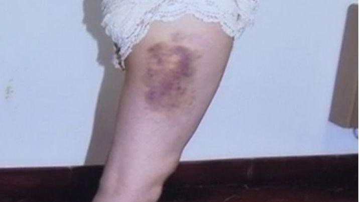 Psicoacuteloga contoacute el calvario que vivioacute durante tres antildeos con su ex