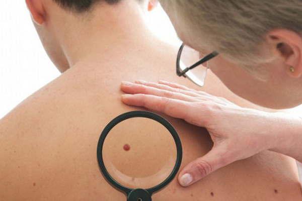 Por la Campantildea de Prevencioacuten del Caacutencer de Piel en Santiago se realizan controles gratuitos esta semana