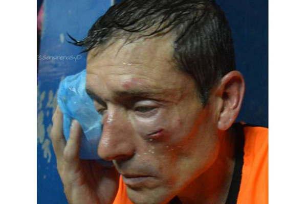 Claudio Elichiri rbitro agredido este fin de semana 