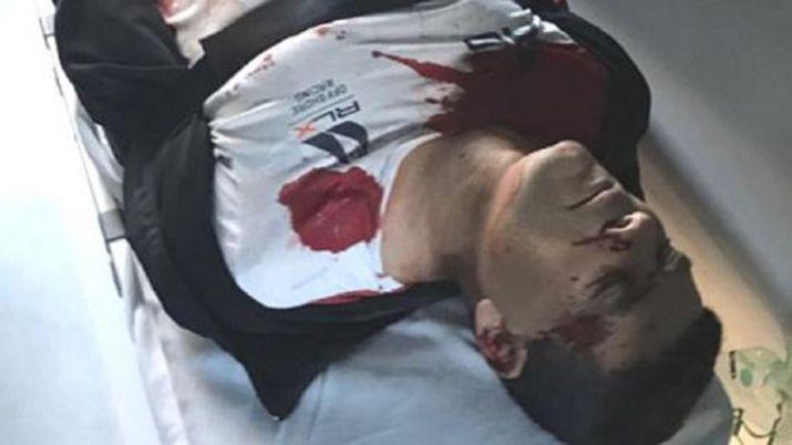 Impactante- la foto del ladroacuten que fue baleado por su viacutectima