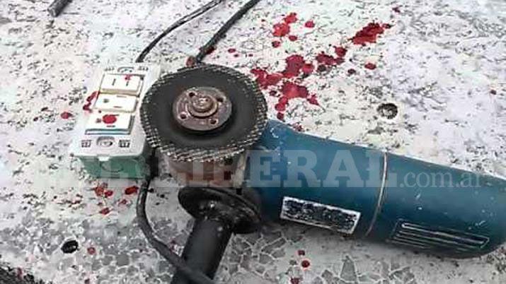 Sufrió una herida con una amoladora mientras trabajaba Foto- Archivo