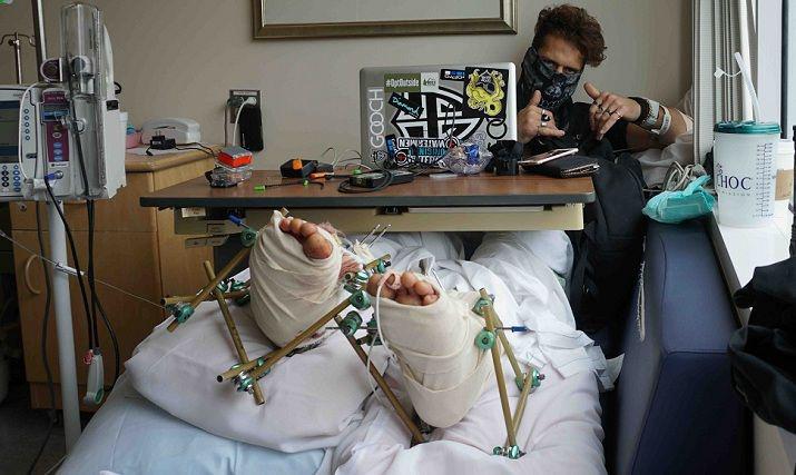 Famoso youtuber se rompe las piernas tras realizar un fallido salto