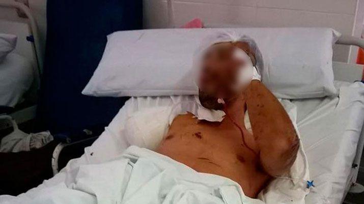 Entroacute a robar lo atacoacute un perro y le cortaron el brazo por las mordidas