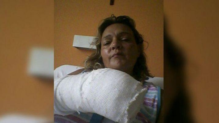 Brutal- atacaron a una policiacutea y le amputaron tres dedos con una puerta